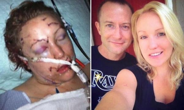 depois-de-muita-luta-melissa-conseguiu-se-salvar-e-ainda-ganhou-o-coracao-do-medico-que-a-socorreu_849901