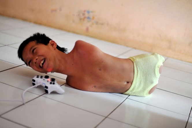 Tiyo Satrio, adolescente de 11 anos que vive na Indonésia e que não tem as pernas nem os braços, aprendeu a jogar videogame usando apenas os ombros e o queixo. 