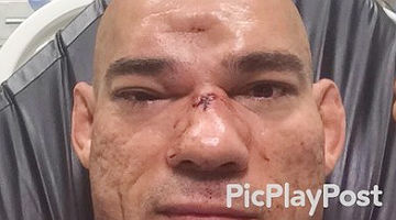 20160718095137204573i