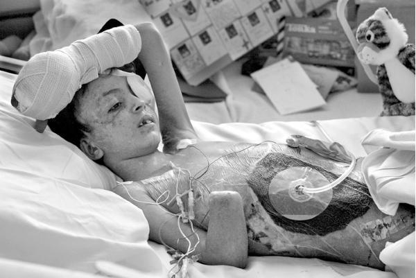 Esta foto rendeu o prêmio Pulitzer de 2005 para Deanne Fitzmaurice, em 2005. Ela registra um garoto iraquiano de 9 anos que foi ferido durante a Guerra do Iraque e tratado na Califórnia, onde teve de passar por dezenas de cirurgias que o deixava entre a vida e morte.