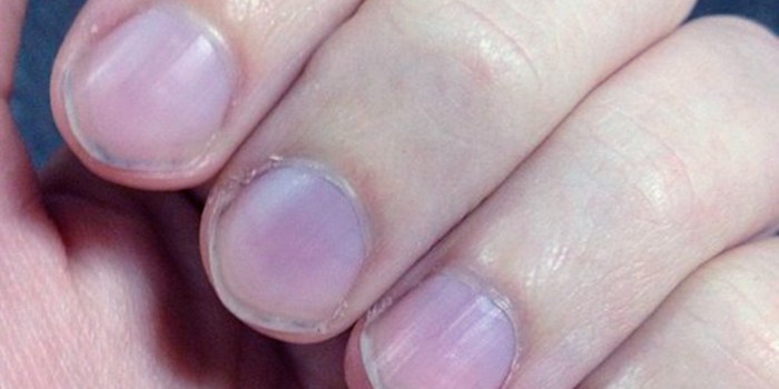 unhas-roxas