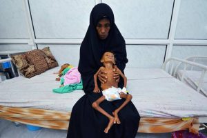 yemen-desnutricao-20161004-005