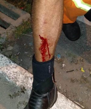Itens comumente usados em casa também podem ser perfurocortantes. Foto: Ascom Sudes